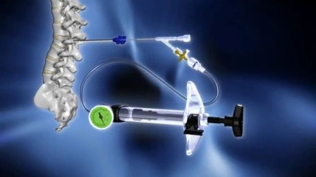 Instruments de chirurgie mini-invasive de la colonne vertébrale orthopédique médicale Dragon Crown